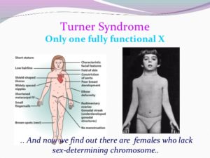 Achievement Center of Texas Turner Syndrome Center
